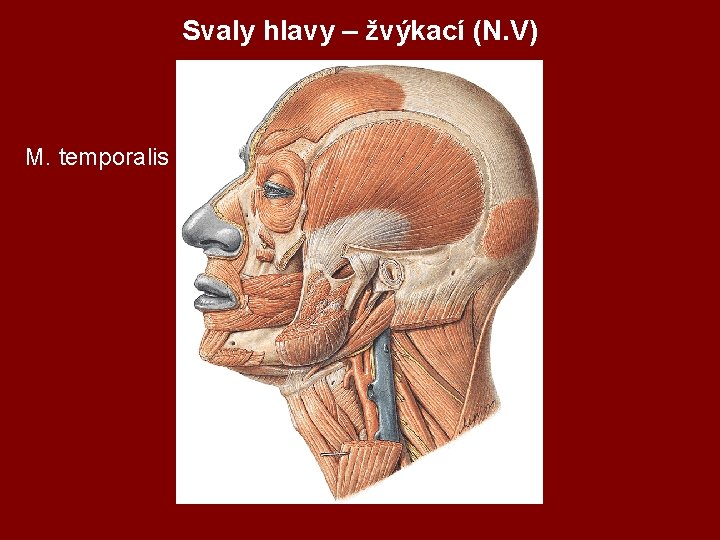 Svaly hlavy – žvýkací (N. V) M. temporalis 
