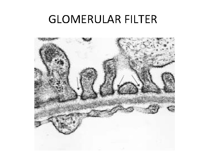 GLOMERULAR FILTER 