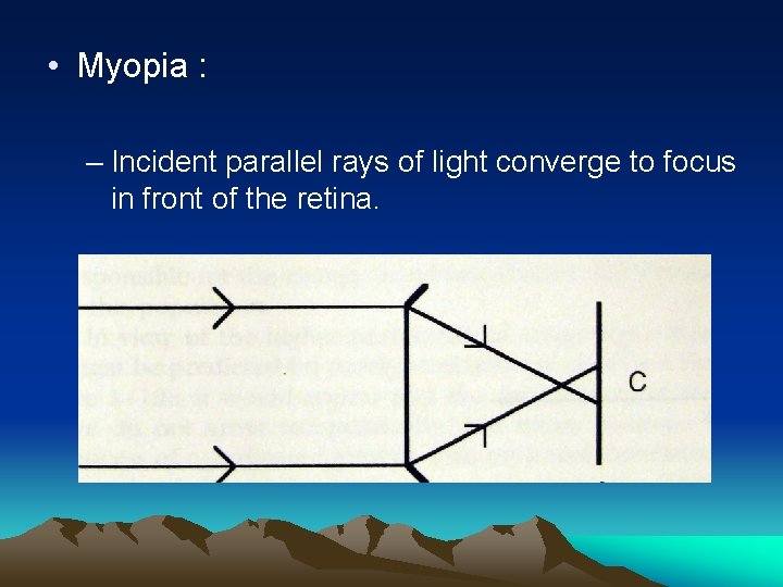  • Myopia : – Incident parallel rays of light converge to focus in