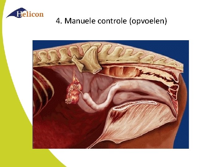 4. Manuele controle (opvoelen) 