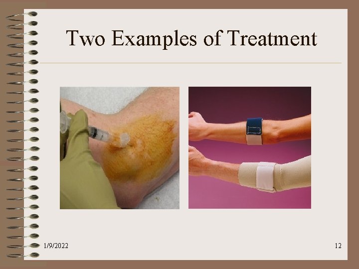 Two Examples of Treatment 1/9/2022 12 