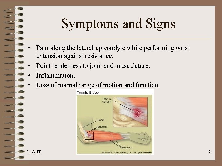 Symptoms and Signs • Pain along the lateral epicondyle while performing wrist extension against