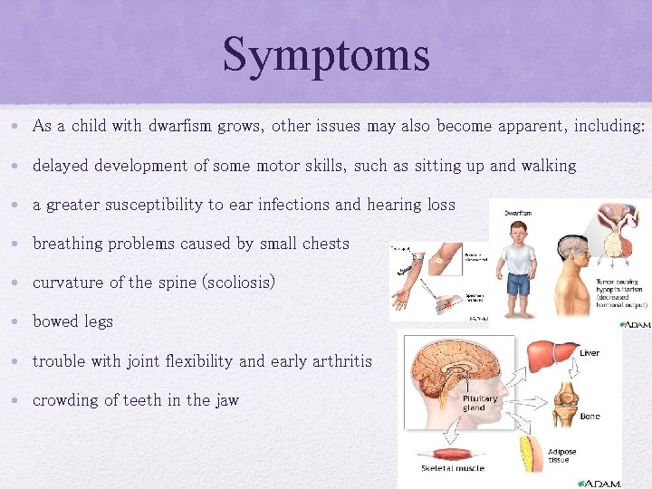 Symptoms • As a child with dwarfism grows, other issues may also become apparent,