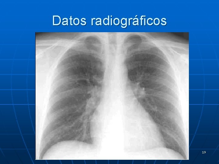 Datos radiográficos 19 