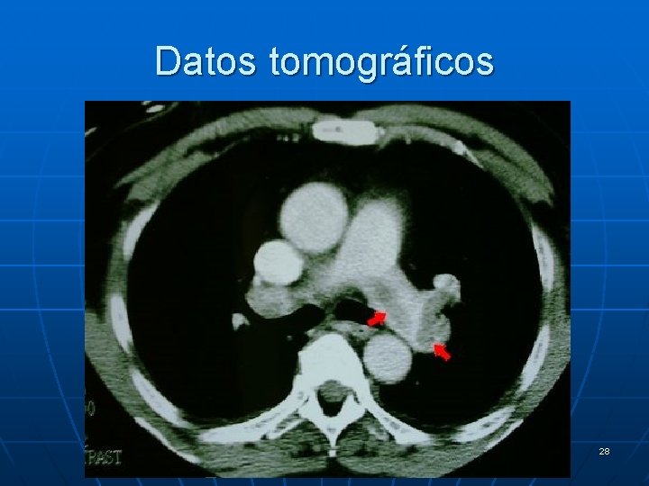 Datos tomográficos 28 
