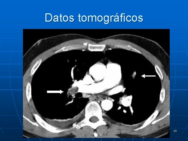 Datos tomográficos 29 