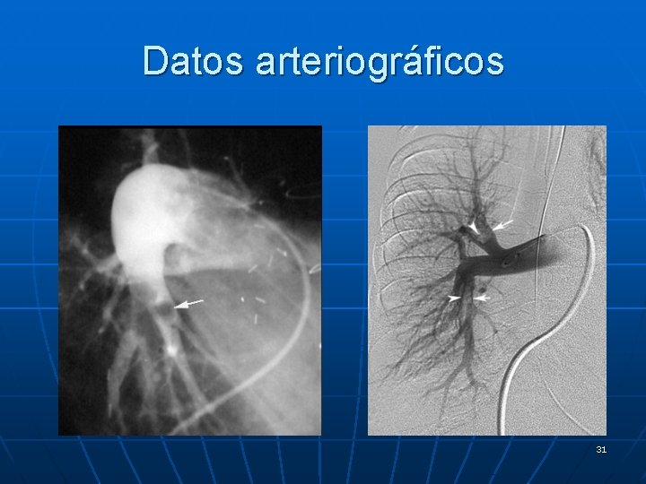 Datos arteriográficos 31 