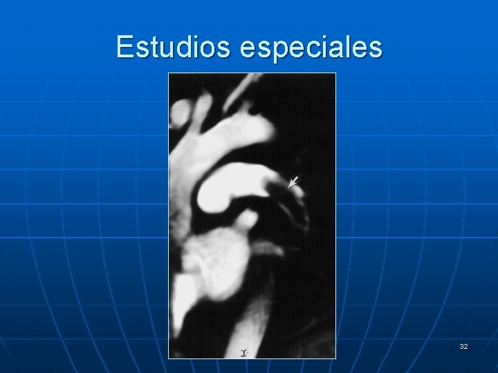 Estudios especiales 32 