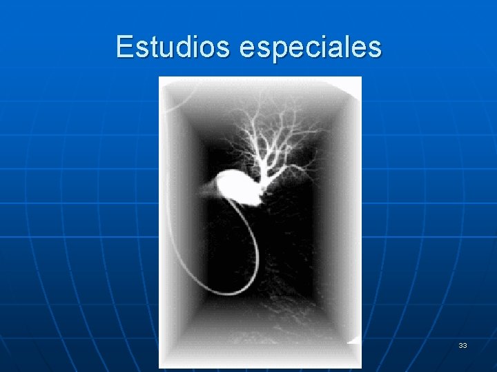 Estudios especiales 33 