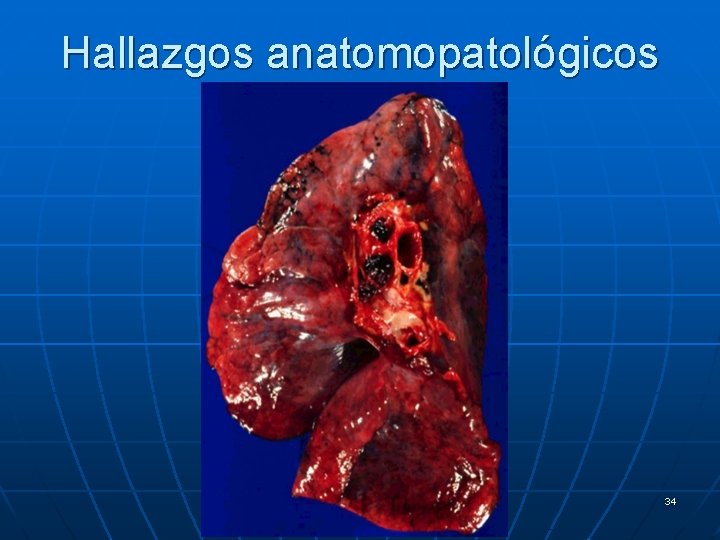 Hallazgos anatomopatológicos 34 