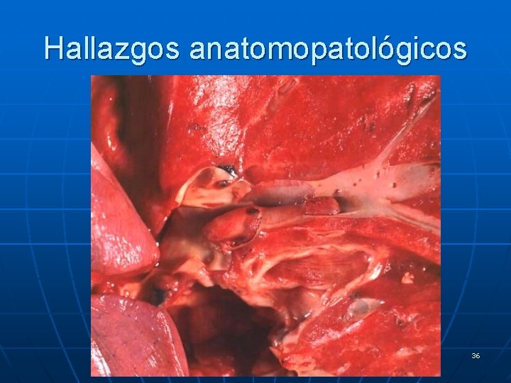 Hallazgos anatomopatológicos 36 
