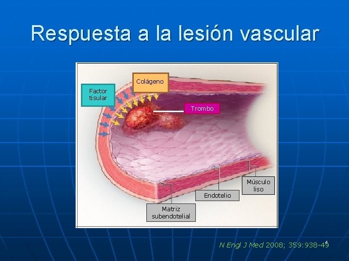 Respuesta a la lesión vascular Colágeno Factor tisular Trombo Endotelio Músculo liso Matriz subendotelial