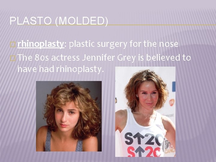PLASTO (MOLDED) � rhinoplasty: plastic surgery for the nose � The 80 s actress