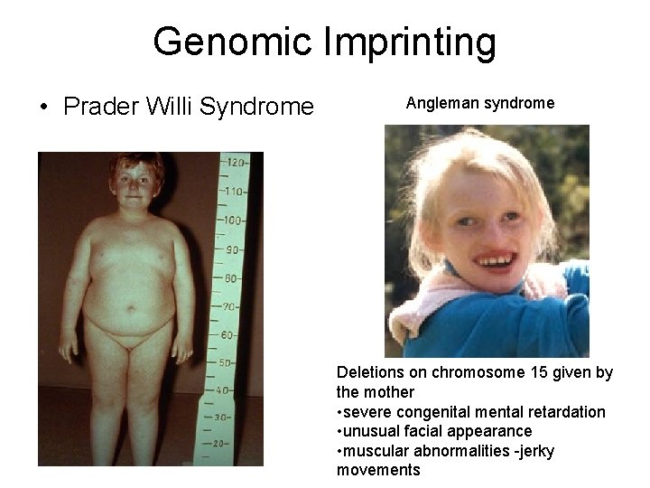 Genomic Imprinting • Prader Willi Syndrome Angleman syndrome Deletions on chromosome 15 given by