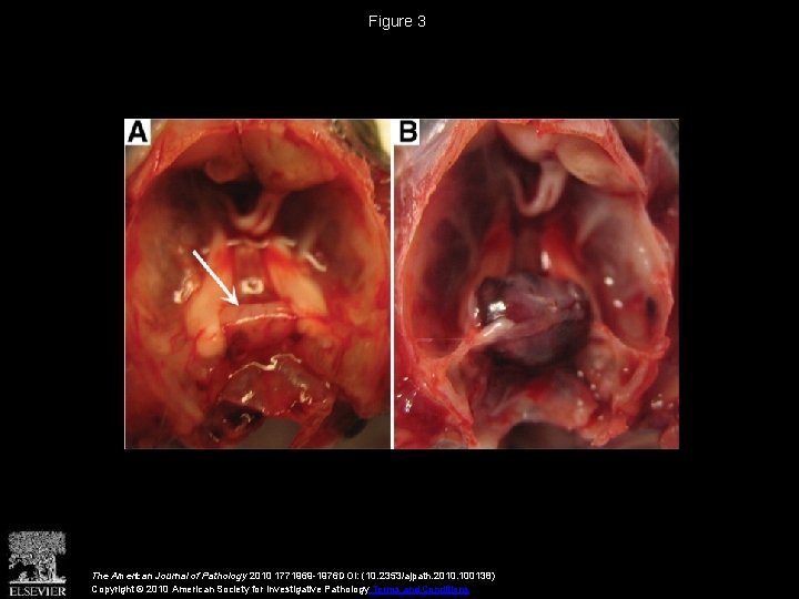 Figure 3 The American Journal of Pathology 2010 1771969 -1976 DOI: (10. 2353/ajpath. 2010.