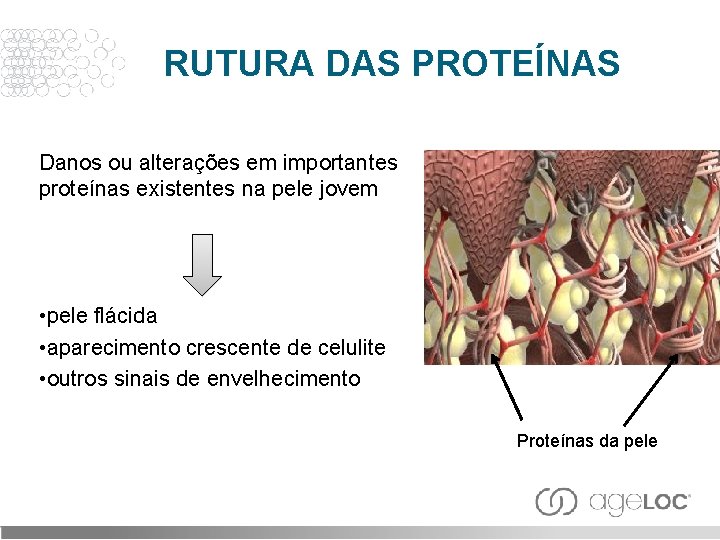 RUTURA DAS PROTEÍNAS Danos ou alterações em importantes proteínas existentes na pele jovem •