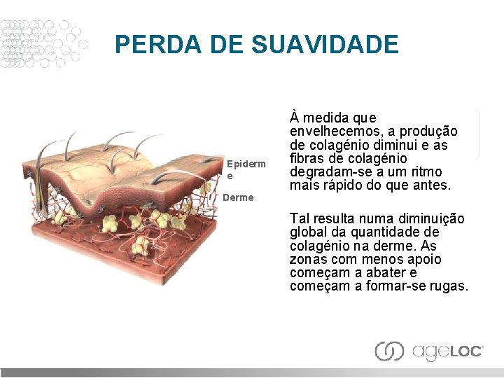 PERDA DE SUAVIDADE Epiderm e Derme À medida que envelhecemos, a produção de colagénio