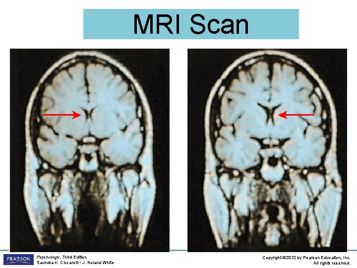 MRI Scan Psychology, Third Edition Saundra K. Ciccarelli • J. Noland White Copyright ©