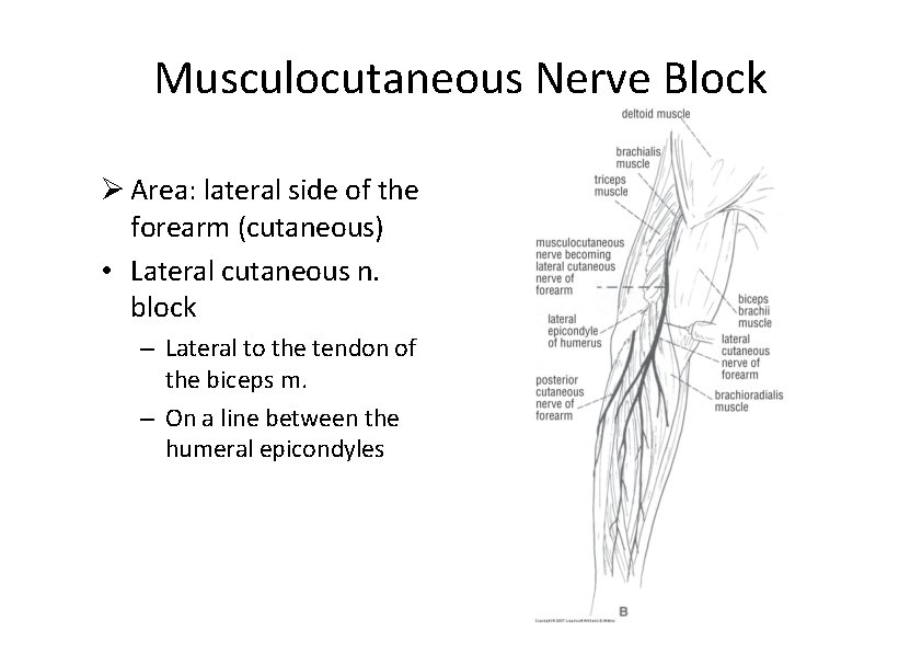 Musculocutaneous Nerve Block Area: lateral side of the forearm (cutaneous) • Lateral cutaneous n.