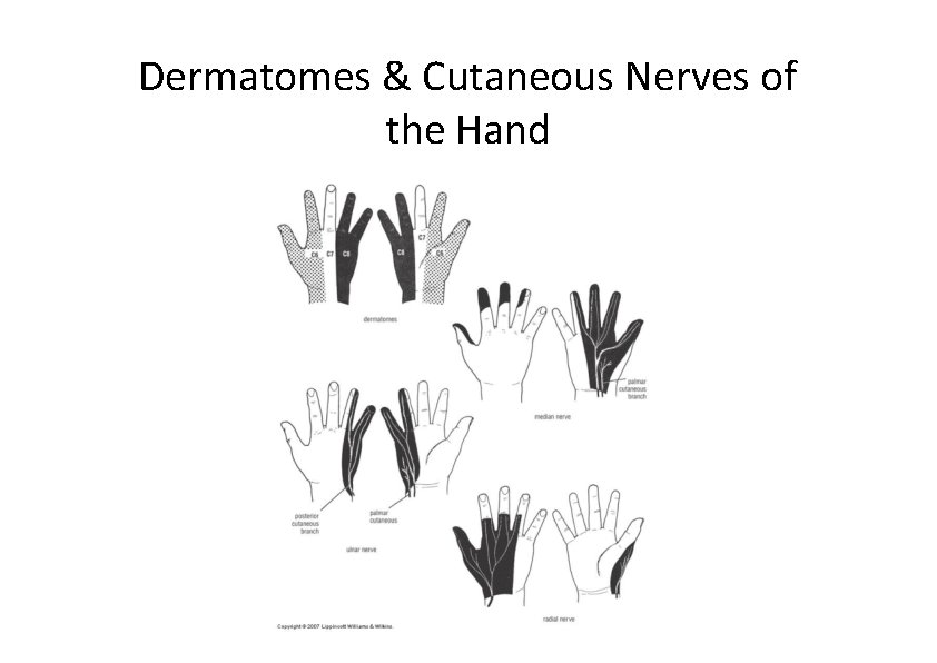 Dermatomes & Cutaneous Nerves of the Hand 