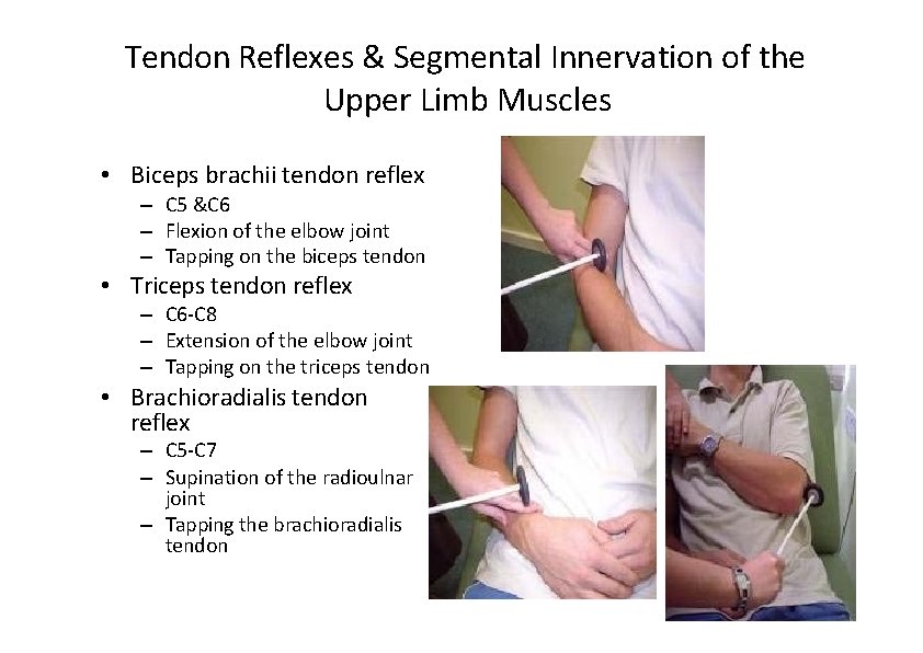 Tendon Reflexes & Segmental Innervation of the Upper Limb Muscles • Biceps brachii tendon