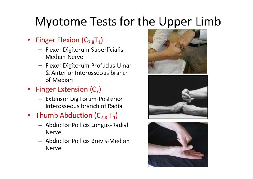 Myotome Tests for the Upper Limb • Finger Flexion (C 7, 8 T 1)