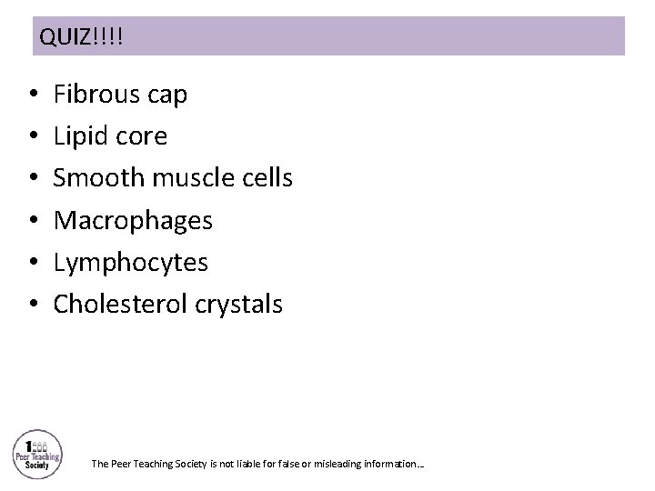 QUIZ!!!! • • • Fibrous cap Lipid core Smooth muscle cells Macrophages Lymphocytes Cholesterol
