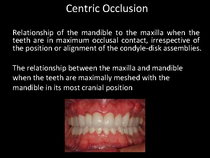 Centric Occlusion Relationship of the mandible to the maxilla when the teeth are in