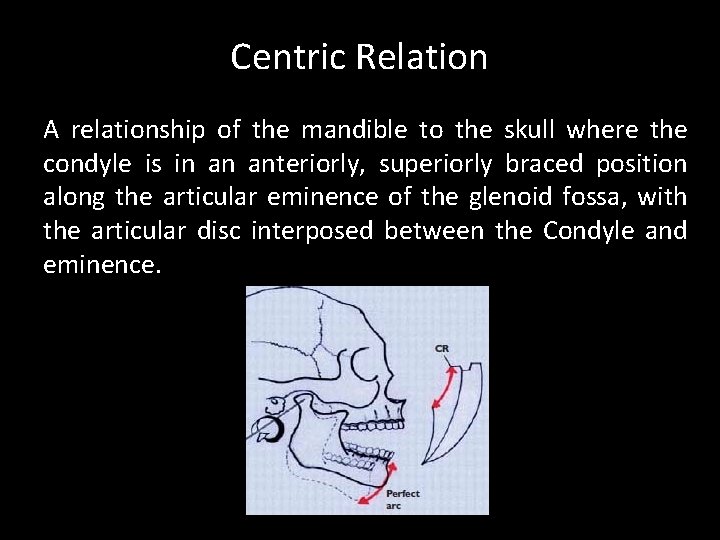 Centric Relation A relationship of the mandible to the skull where the condyle is