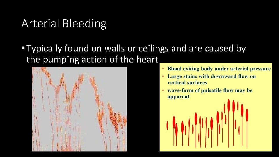 Arterial Bleeding • Typically found on walls or ceilings and are caused by the