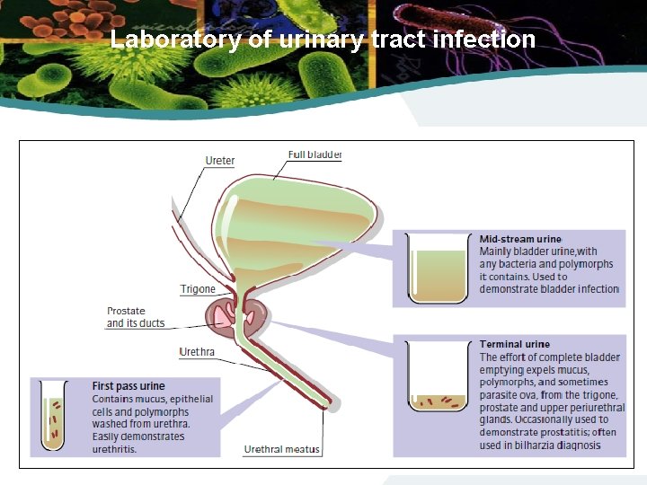Laboratory of urinary tract infection 