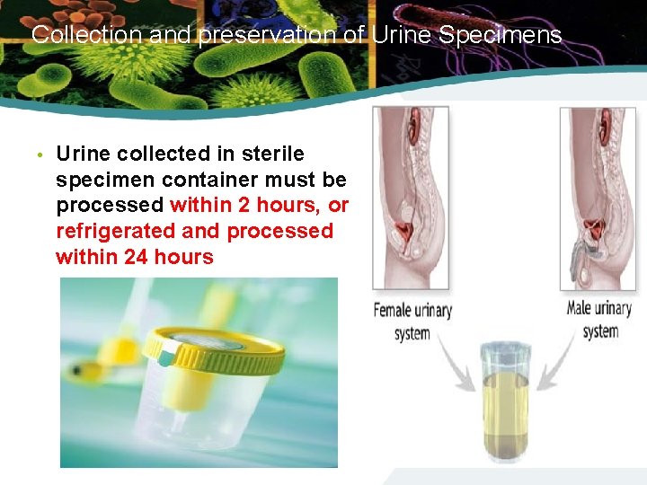 Collection and preservation of Urine Specimens • Urine collected in sterile specimen container must