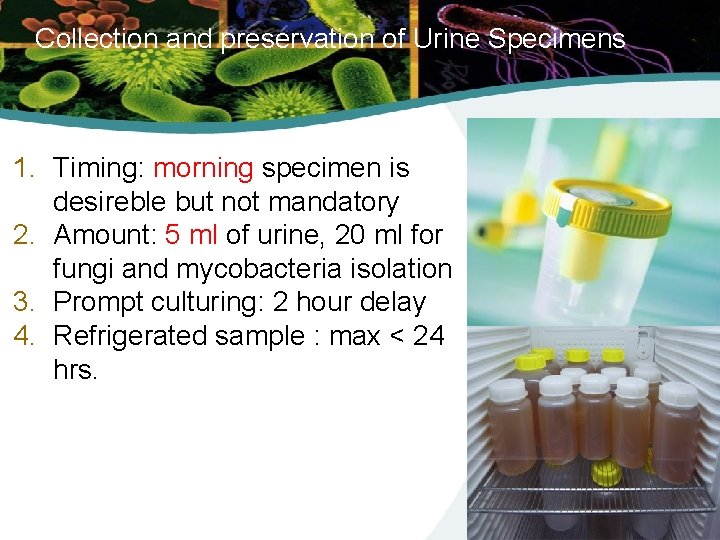 Collection and preservation of Urine Specimens 1. Timing: morning specimen is desireble but not