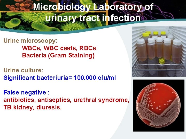 Microbiology Laboratory of urinary tract infection Urine microscopy: WBCs, WBC casts, RBCs Bacteria (Gram