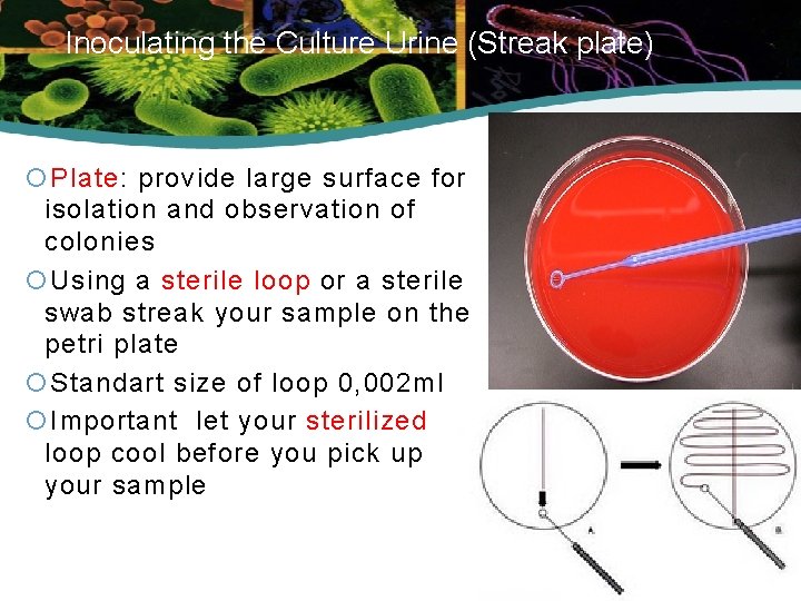 Inoculating the Culture Urine (Streak plate) Plate: provide large surface for isolation and observation