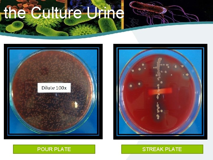 the Culture Urine POUR PLATE STREAK PLATE 