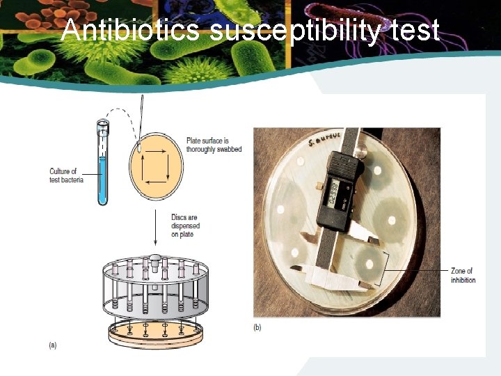 Antibiotics susceptibility test 