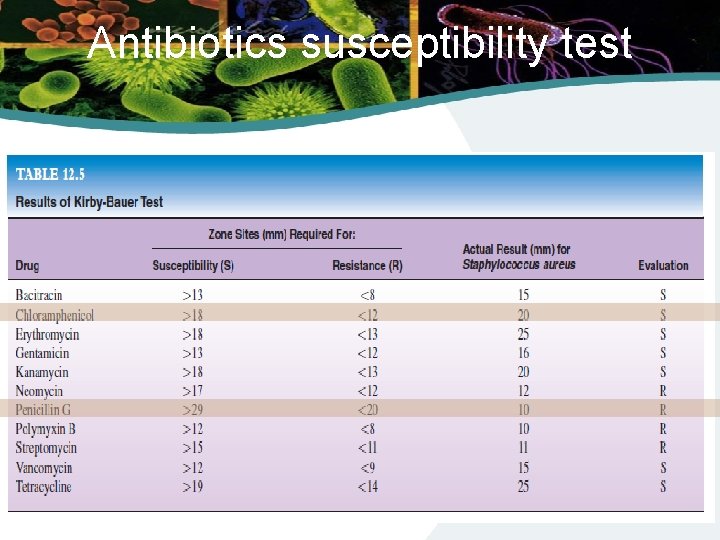 Antibiotics susceptibility test 