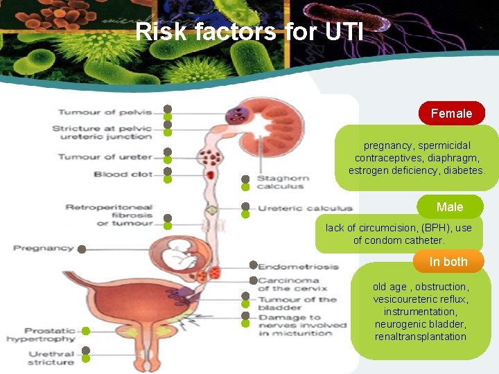 Risk factors for UTI Female pregnancy, spermicidal contraceptives, diaphragm, estrogen deficiency, diabetes. Male lack