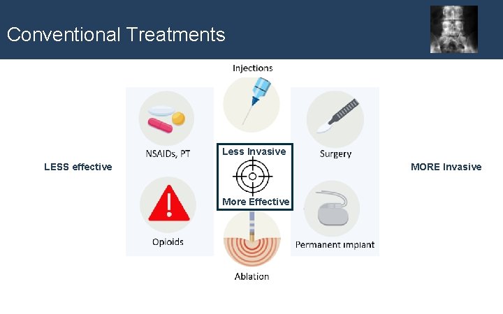Conventional Treatments Less Invasive MORE Invasive LESS effective More Effective 