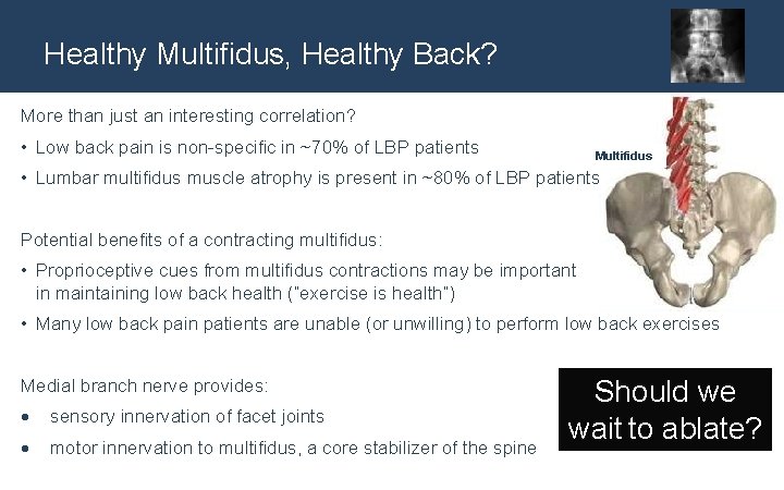 Healthy Multifidus, Healthy Back? More than just an interesting correlation? • Low back pain
