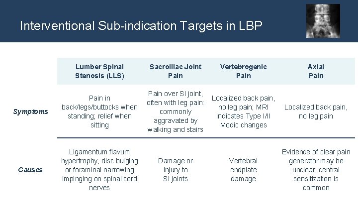 Interventional Sub-indication Targets in LBP Lumber Spinal Stenosis (LLS) Sacroiliac Joint Pain Vertebrogenic Pain