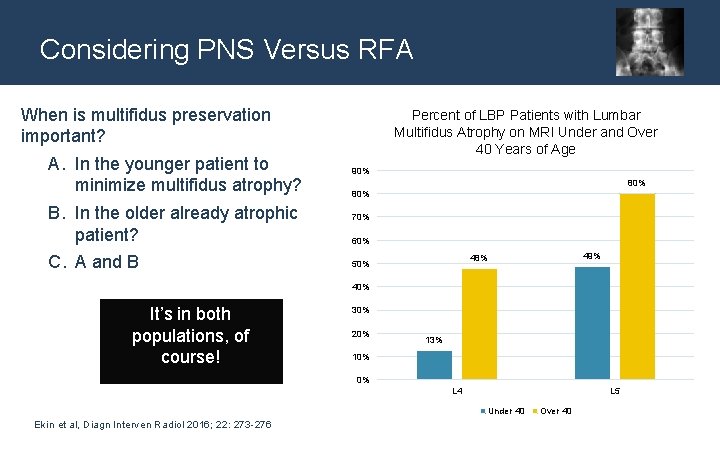 Considering PNS Versus RFA When is multifidus preservation important? A. In the younger patient