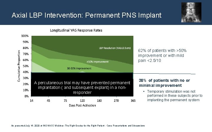 Axial LBP Intervention: Permanent PNS Implant 62% of patients with >50% improvement or with