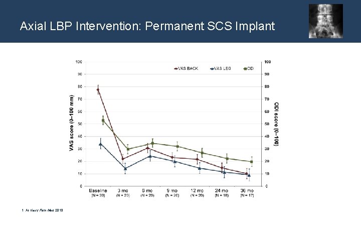 Axial LBP Intervention: Permanent SCS Implant 1. Al-Kaisy Pain Med 2018 