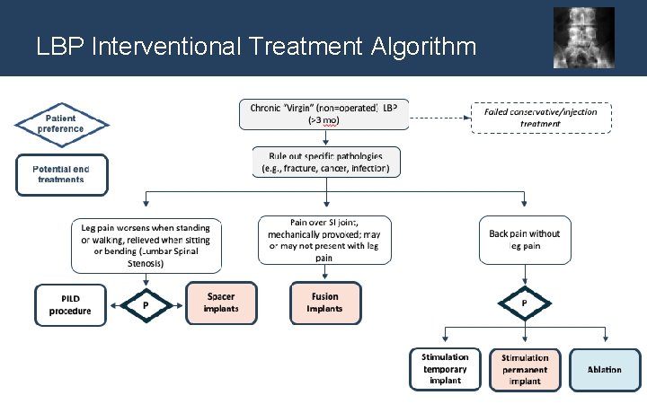 LBP Interventional Treatment Algorithm 