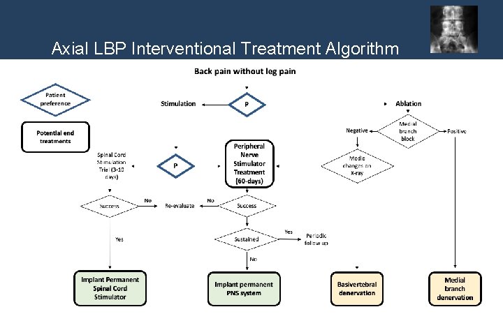 Axial LBP Interventional Treatment Algorithm 