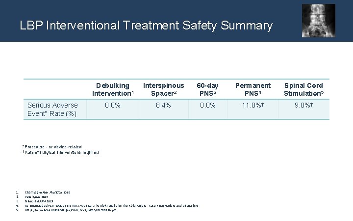 LBP Interventional Treatment Safety Summary Debulking Intervention 1 Interspinous Spacer 2 60 -day PNS