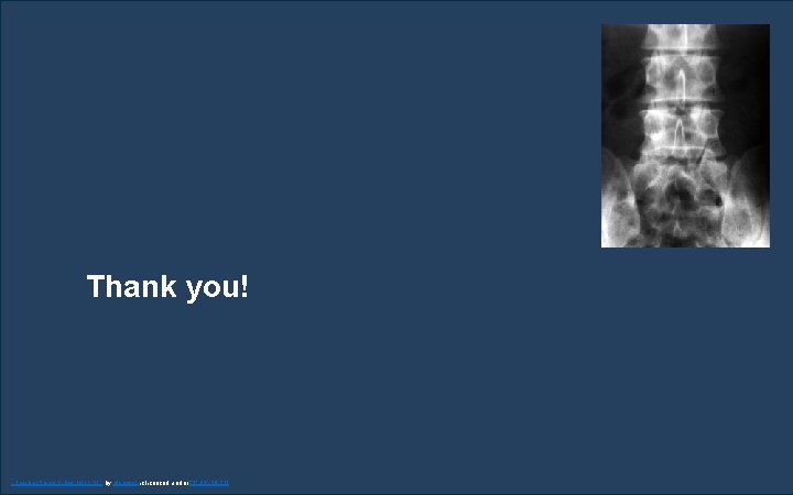 Thank you! "Lumbar Spine X-Ray L 4 L 5 S 1" by planetc 1