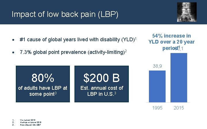Impact of low back pain (LBP) #1 cause of global years lived with disability